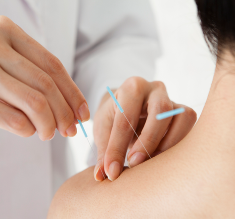 Why Everyone Is Talking About Non-Opioid Pain Management (And You Should Too)